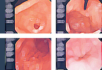 (胃カメラ/大腸内視鏡)